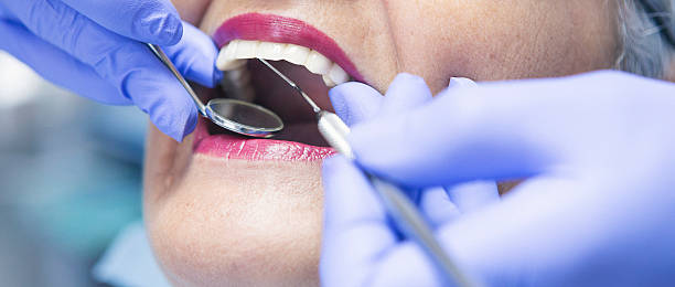 Best Emergency Root Canal Treatment in Pierce, NE