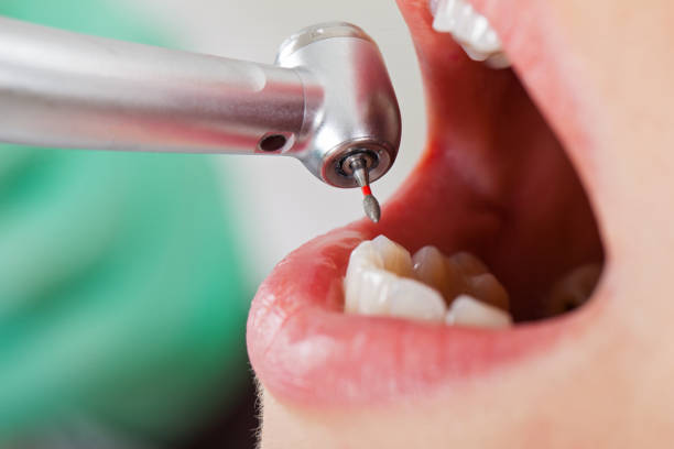 Best Weekend Emergency Dentist in Pierce, NE